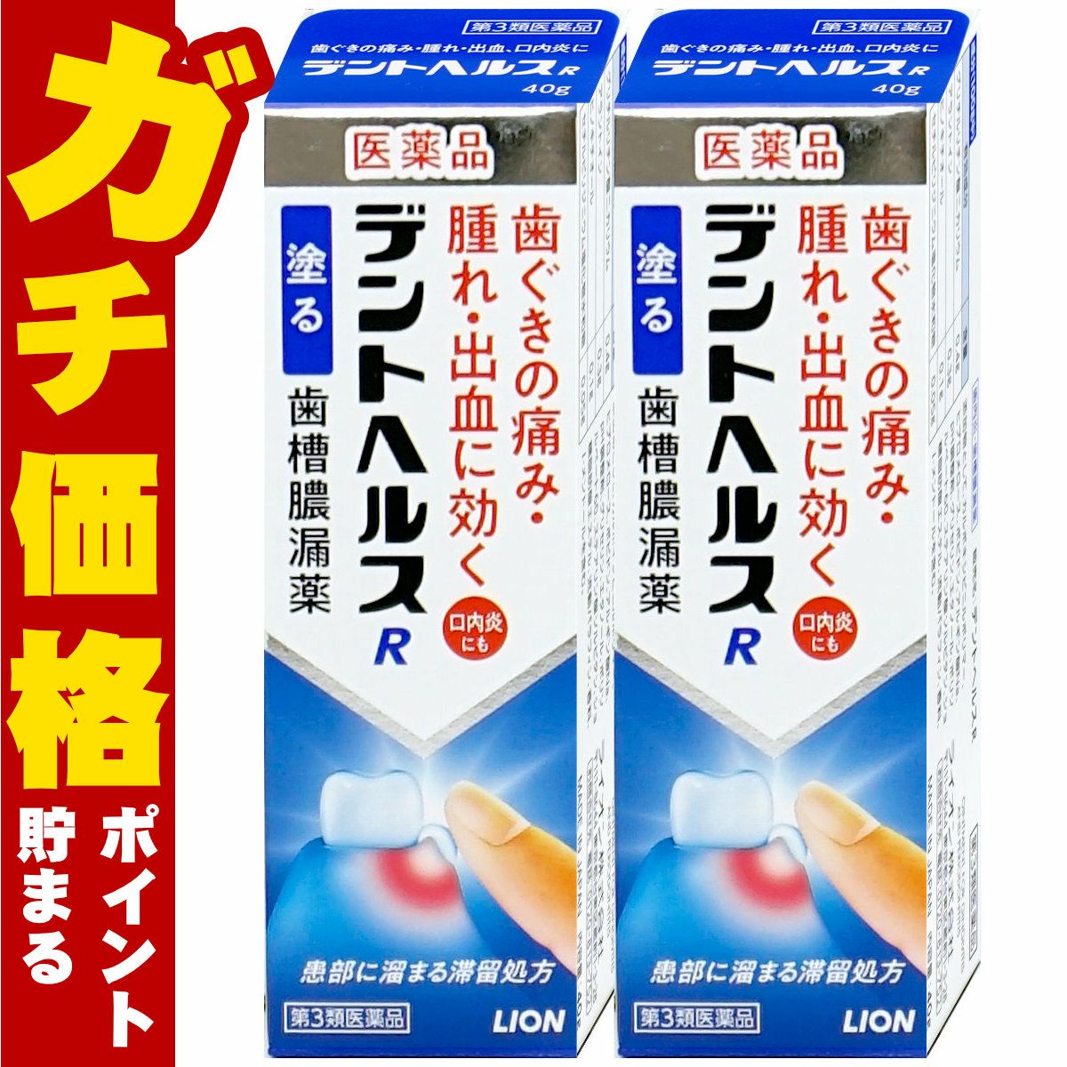コスメ通販　【第3類医薬品】デントヘルスR 40g×2個