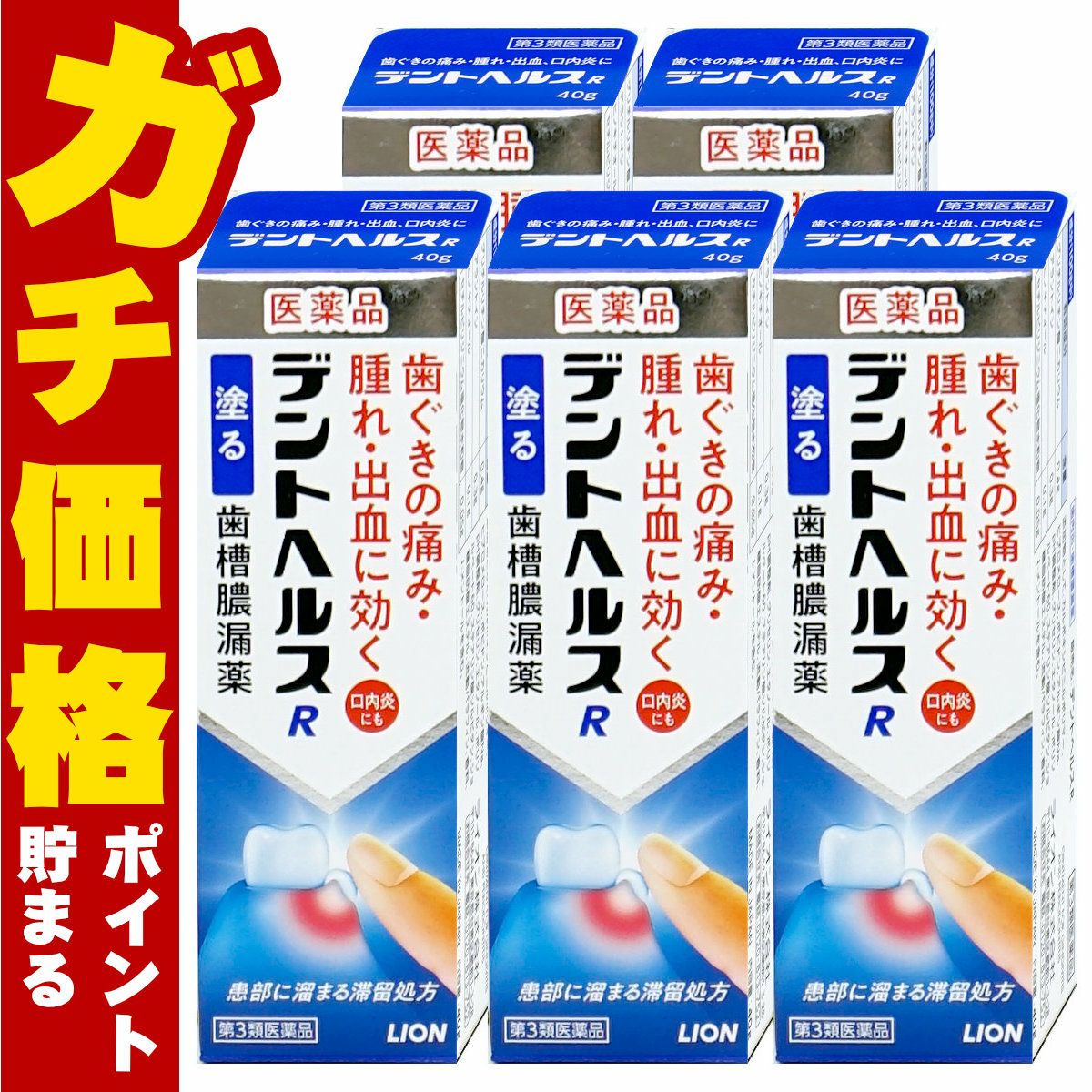 コスメ通販　【第3類医薬品】デントヘルスR 40g×5個