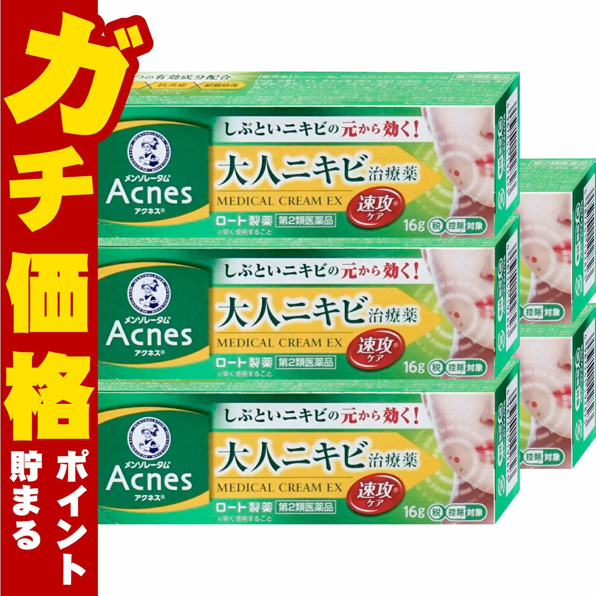 通販　【第2類医薬品】【セット】メンソレータム アクネス25 メディカルクリームEXa 16g×5個(セルフメディケーション税制対象)【ロート製薬】【皮膚の薬】