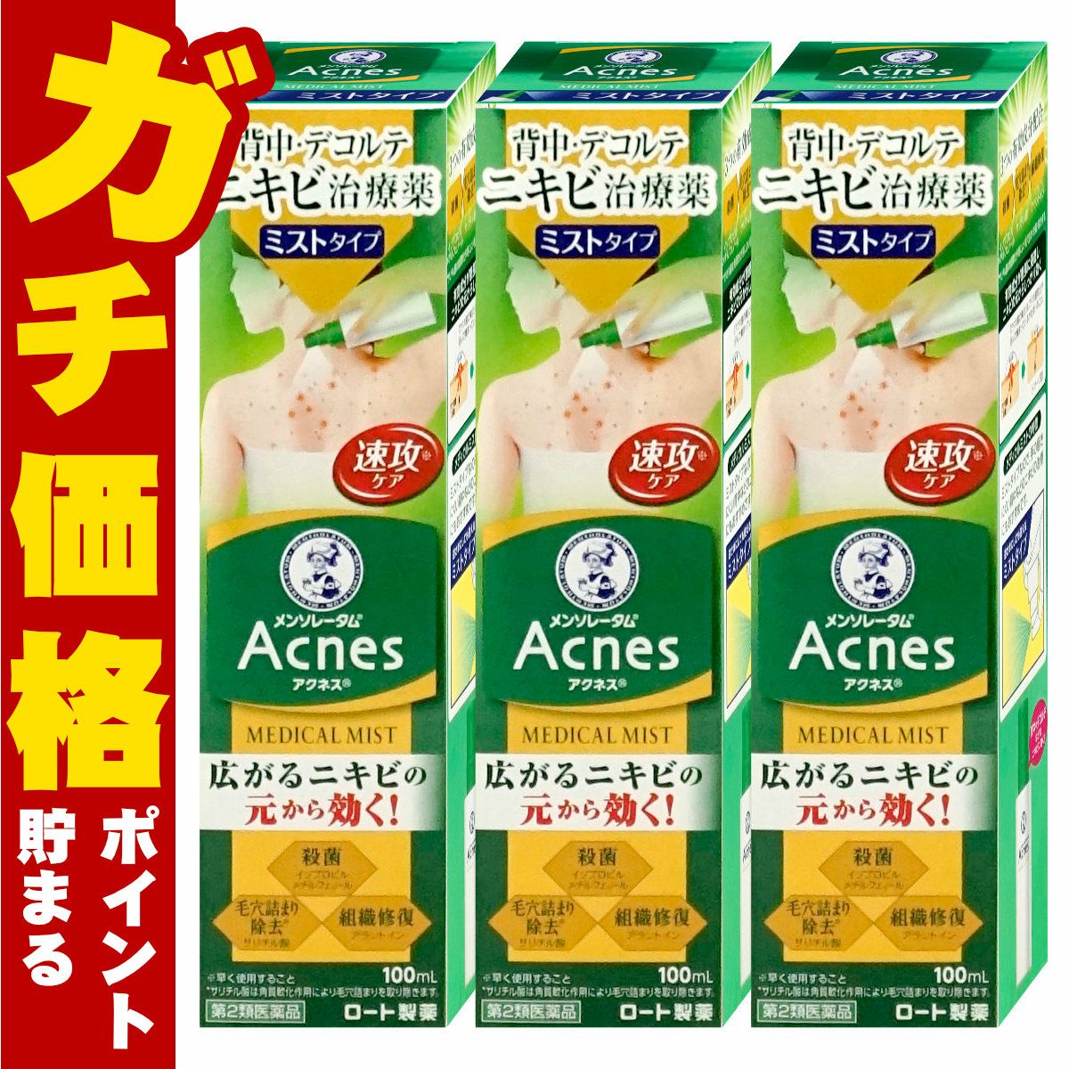 通販　【第2類医薬品】【セット】メンソレータム アクネス25 メディカルミストb 100ml×3個【ロート製薬】【皮膚の薬】